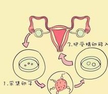 在北京打三代试管婴儿可以买医疗保险吗？北京办理需要多少钱三代试管婴儿